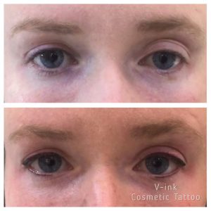 before and after Eyeliner Tattoo Melbourne